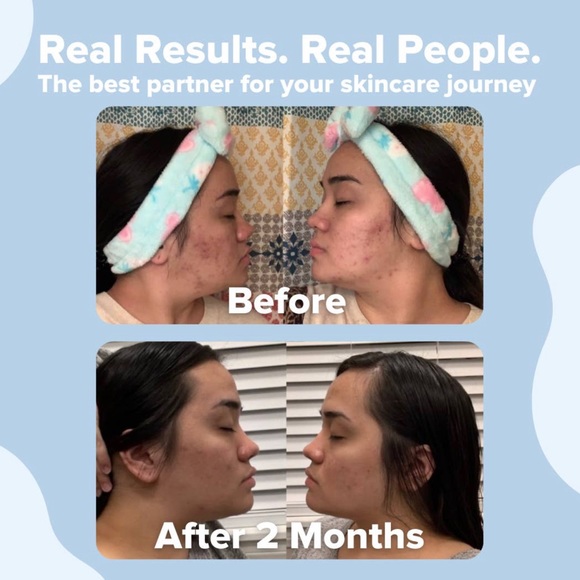 Clean Skin Club Towels XL Super Soft for Sensitive Skin 50 Count - NIB - SEALED - Picture 2 of 7